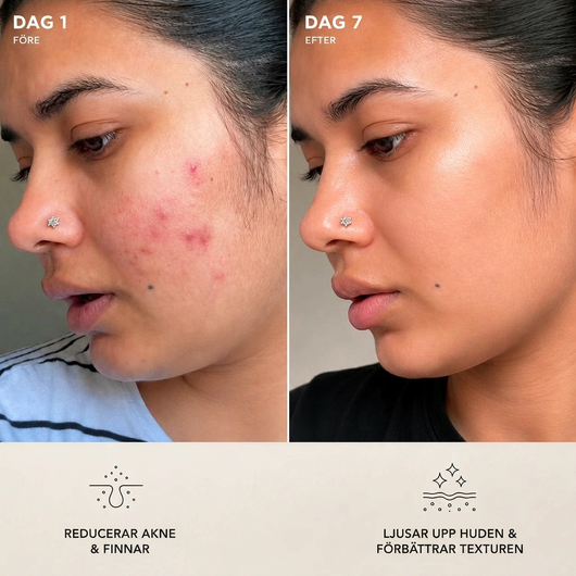 Centella® - Tone Brightening Capsule Ampoule