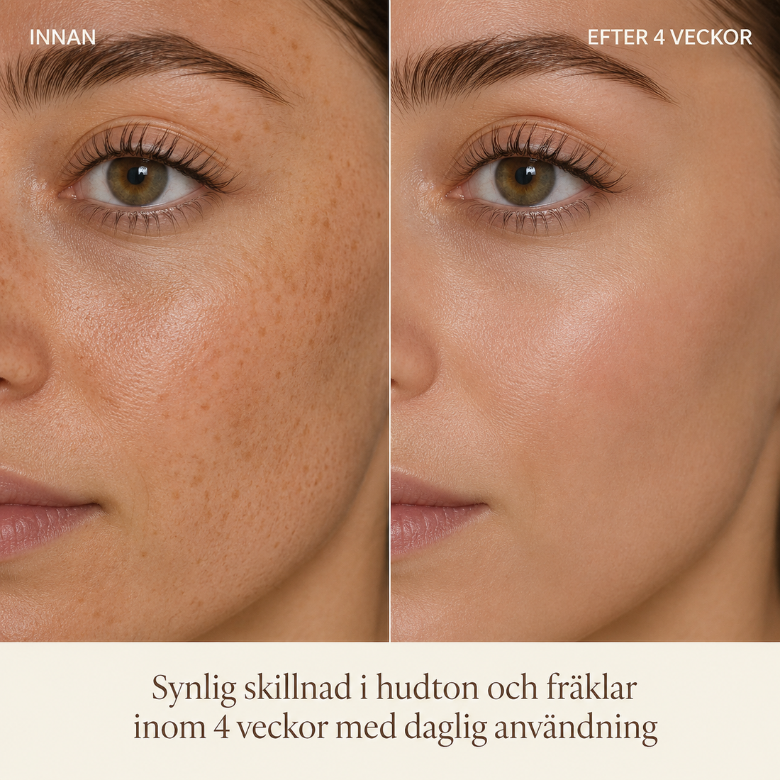 Det första du märker <em>är inte fläckarna.</em>